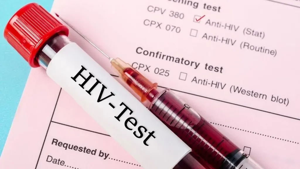 HIV dünyada azalıyor, Türkiye'de artıyor!